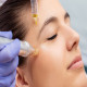 Can Microneedling Reduce The Appearance Of Fine Lines And Wrinkles?