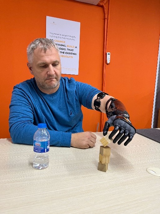 Enhancing Daily Activities: Functionalities of Bionic Hands and Arms