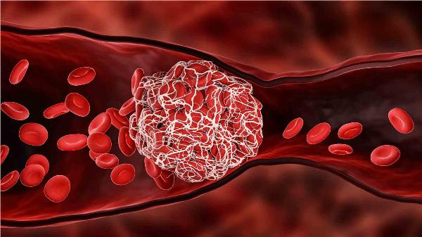 Discovery of Molecular Glue Degraders