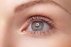 Discovering the Reasons Behind Post-Surgery Eye Anomalies