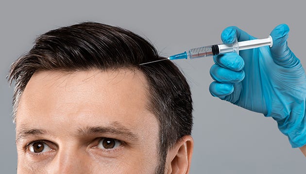 GFC Treatment Fever Hits Dubai: Your Path to Hair Perfection!