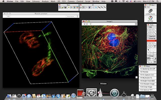 Microscope Software Market Size, Share, Trends and Growth 2024-2032