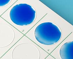 Latex Agglutination Test Kits Market Outlook, Share, Growth Drivers, and Forecast 2024-2032