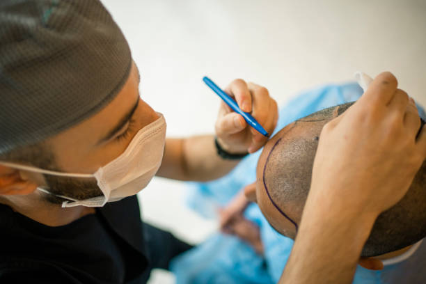 Unlock Confidence: Hair Transplant in Abu Dhabi