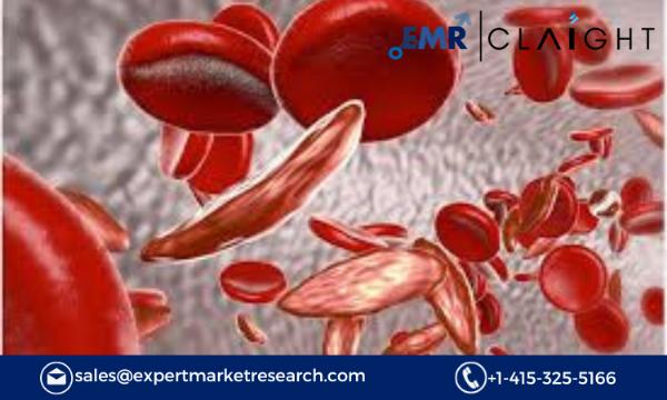 Hospital Sickle Cell Disease Treatment: A Comprehensive Market Outlook