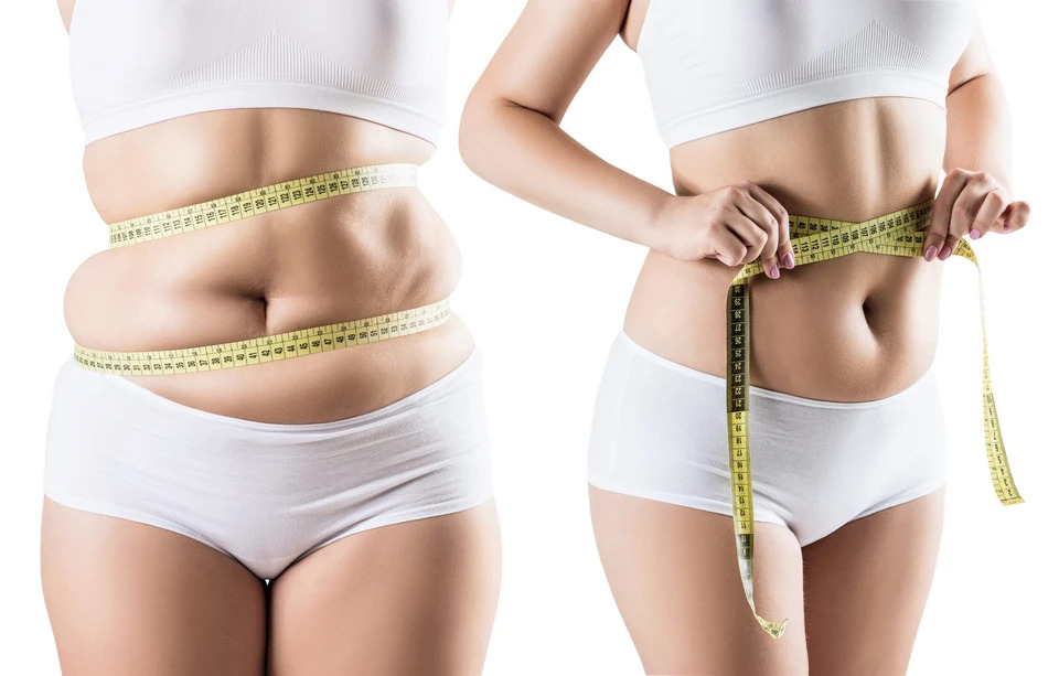 Liposuction Procedure: Post Surgery Recovery Guide