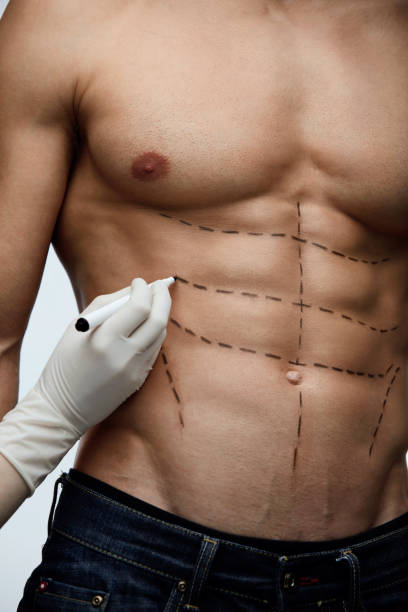 Enhance Your Figure: Lipo Abdominoplasty Options in Abu Dhabi