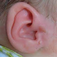 Uncover Confidence | Preauricular Tag Removal Options in Abu Dhabi