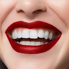 "Hollywood Smiles on a Global Scale: Cultural Perspectives on Smile Makeovers"