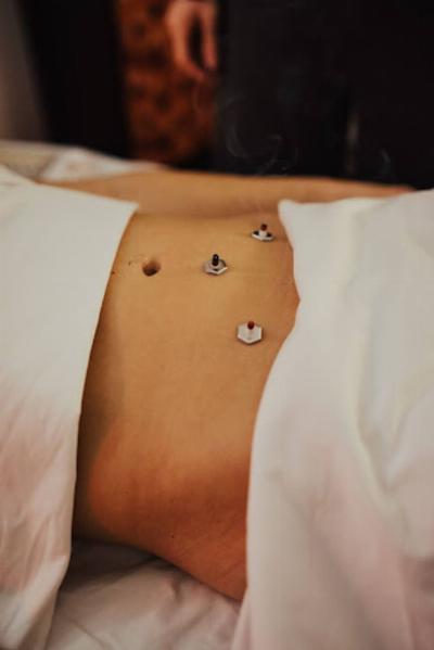 Unlocking the Power of Acupuncture for Digestive Issues