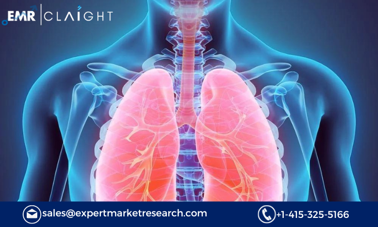 Exploring the Pulmonary Drug Delivery Systems Market: Trends, Segmentation, and Future Outlook 2024-2032
