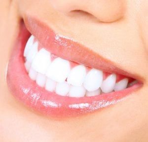 The Ultimate Guide to Teeth Whitening in Dubai: Everything You Need to Know