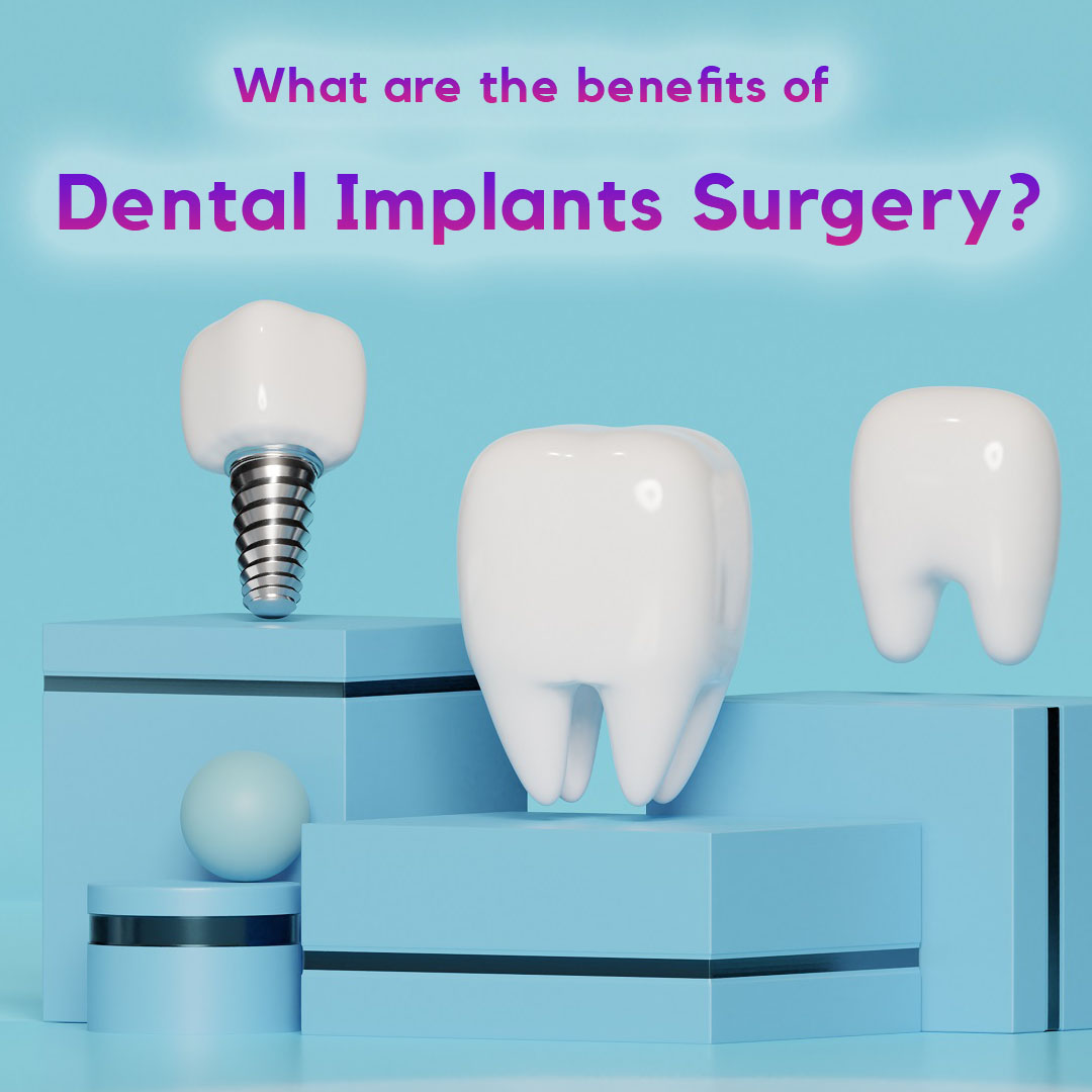 What are the benefits of Dental Implants Surgery?
