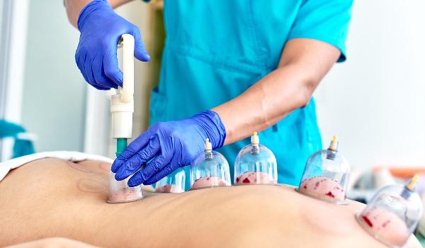 Renew Your Energy: Hijama Treatment for Wellness Warriors