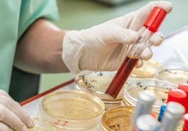 Red Biotechnology Market Forces Strategy Analysis and Forecast 2022 – 2030