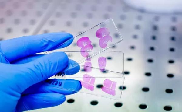 Immunohistochemistry Market Trends, Key Players, Driver, Segmentation, Forecast to 2016-2030