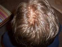 The Ultimate Destination for Men's Hair Pieces