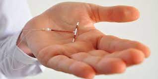 Comparative Analysis: Mirena IUD Insertion Costs in Dubai vs. Global Markets