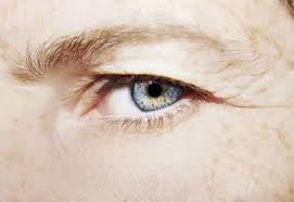 Introduction to Blepharoplasty What is Eyelid Surgery