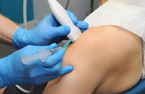 Sonoscope's Advanced Rotator Cuff Injection Solutions