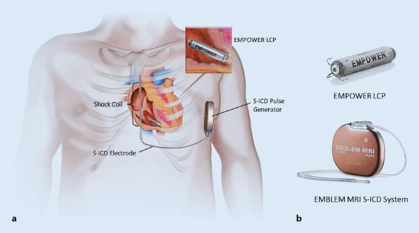 Cardiac Rhythm Management Devices Market Trends: Size, Share, and Growth Forecast