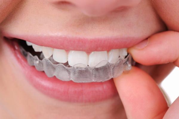 Choosing the Right Night Guard Splint for Your Dental Health