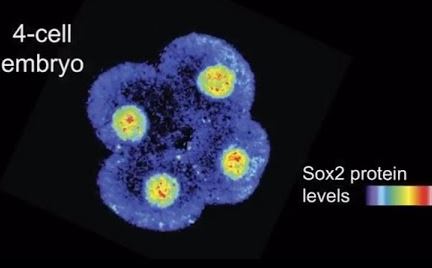 Macrophages as Biomarkers of Non-Alcoholic Fatty Liver Disease Progression