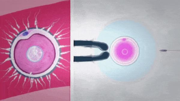 Emerging Trends in In Vitro Fertilization Market: Size and Share Analysis