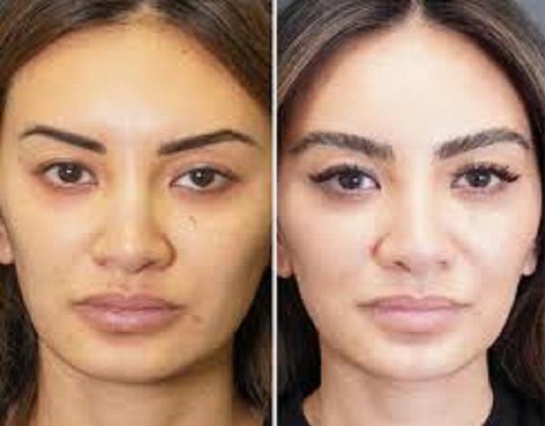 Is it safe to continue tinting after an allergic reaction?