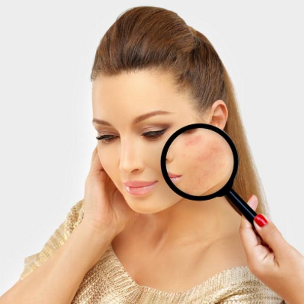 Vanishing Act: The Science of Laser Scar Removal