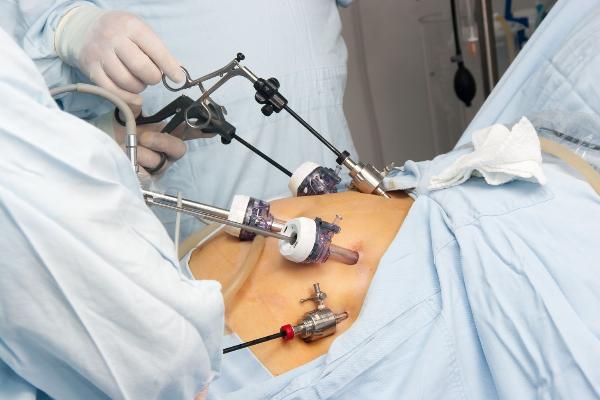 Brazil Bariatric Surgery Market Size, Share, Growth & Demand 2024-2032