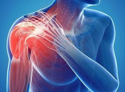 Nerve Pain and the Central Nervous System: What You Need to Know | healthcurepills