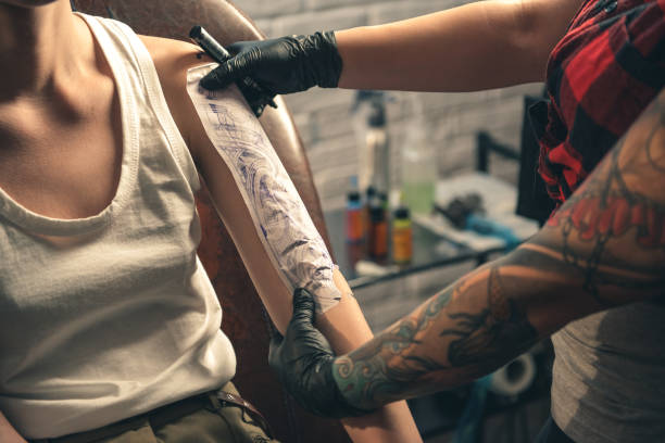 Laser Precision: Tattoo Removal Experts in Riyadh