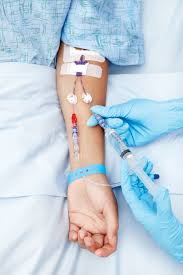 Improve Cognitive Function: Explore the Potential of Glutathione IV Drips in Dubai