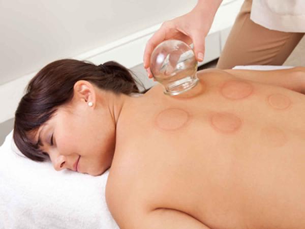 What to Expect When Paying for Hijama Treatment in Dubai