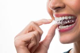 10 Reasons Why Aligners Are the Future of Orthodontics