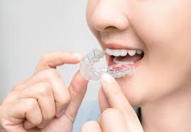 How Clear Aligners Improve Oral Health