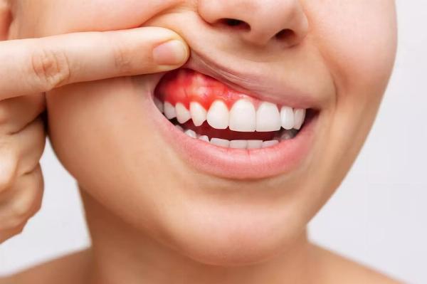 Dubai Dental How Much Does a Full Mouth Implant Treatment Cost?