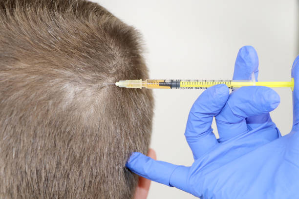 Enhance Your Beauty: Concentrated Growth Factor Therapy in Riyadh
