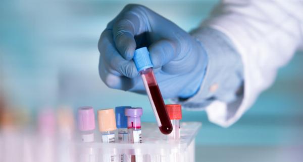 Discover Your Vitality in Dubai: Home Blood Test for Comprehensive Body Analysis