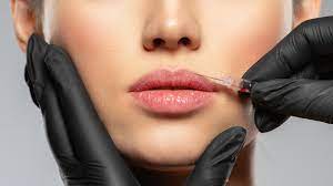 Combining Lip Fillers with Other Facial Treatments