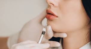 Seasonal Lip Filler Trends: What's Hot Right Now?