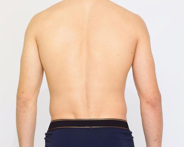 What to Do After Fat Dissolving Injections? Your Essential Guide for Optimal Results!