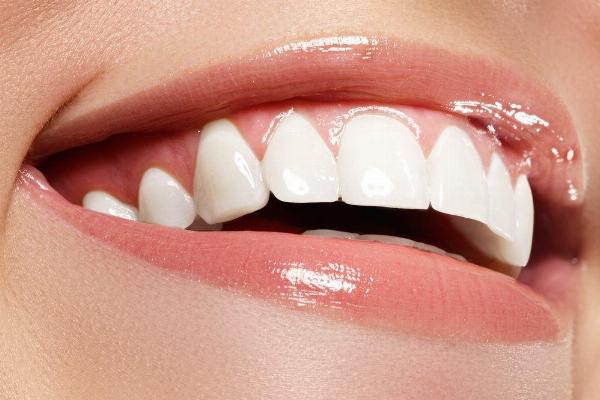 How Zoom Teeth Whitening Can Transform Your Smile in Dubai