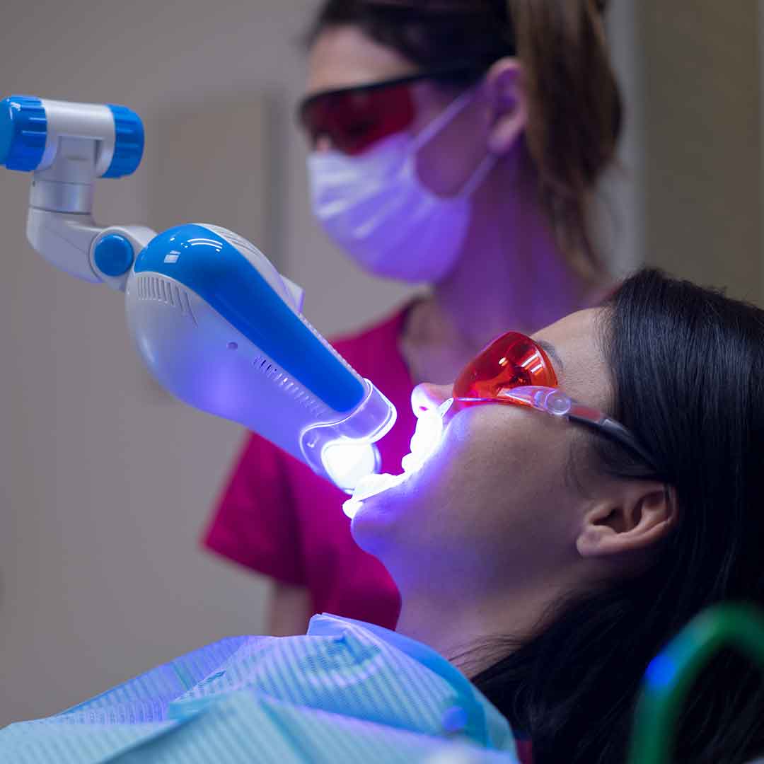 The Benefits of Choosing Zoom Teeth Whitening for a Brighter Smile