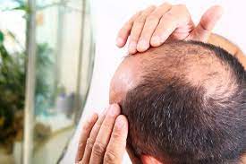 A Comprehensive Guide to Finasteride Prices in the UAE