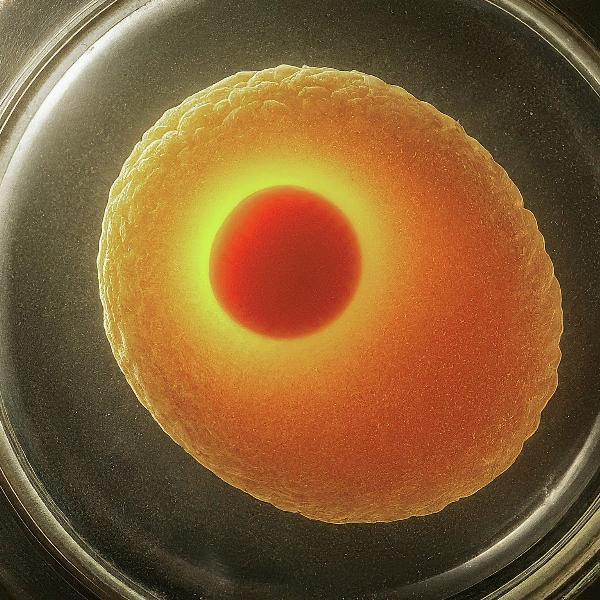How Long Does an IVF Cycle Take from Start to Finish?