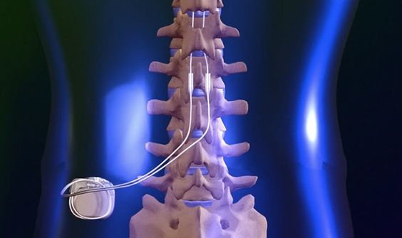 Spinal Pumps Market Globally Expected to Drive Growth through 2022-2030