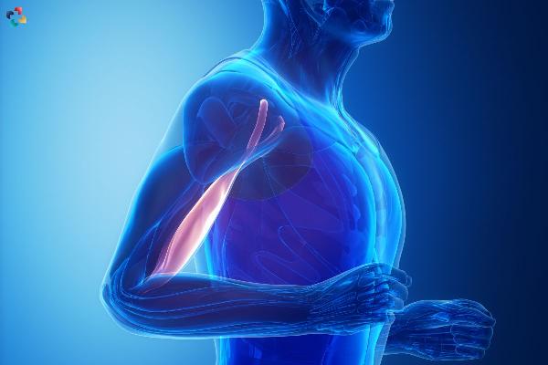 Distal Biceps Tendonitis: Understanding, Diagnosis, and Treatment