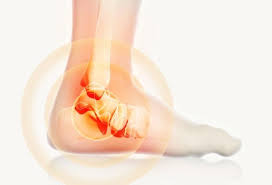 Legend Physiotherapy: Expert Ankle Sprains Physiotherapy in Surrey